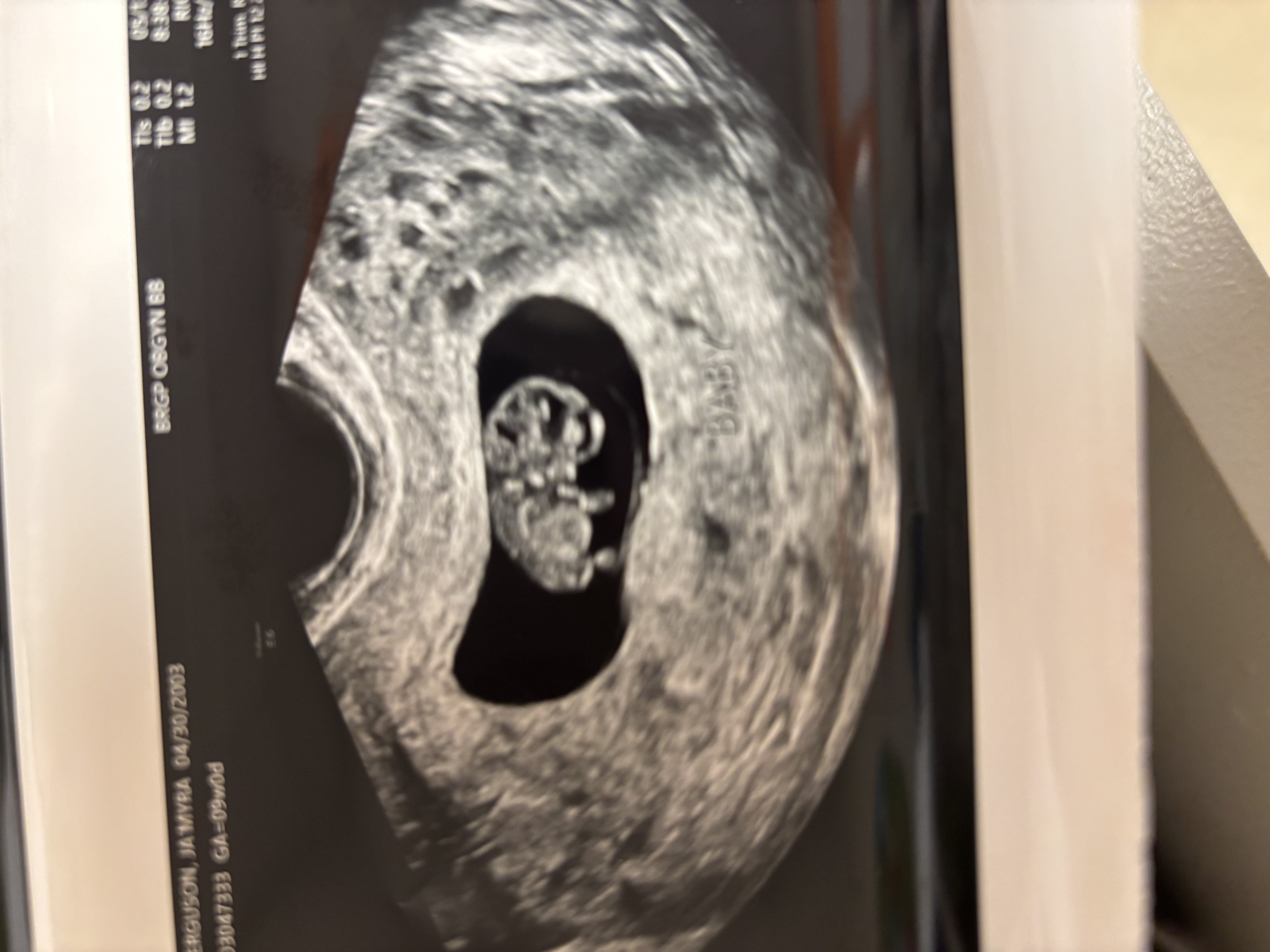 Ja’Myra Ferguson's Registry